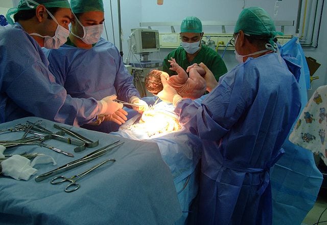 Doctors delivering a baby. A doctor may decide to perform an episiotomy to ensure an easier birth.