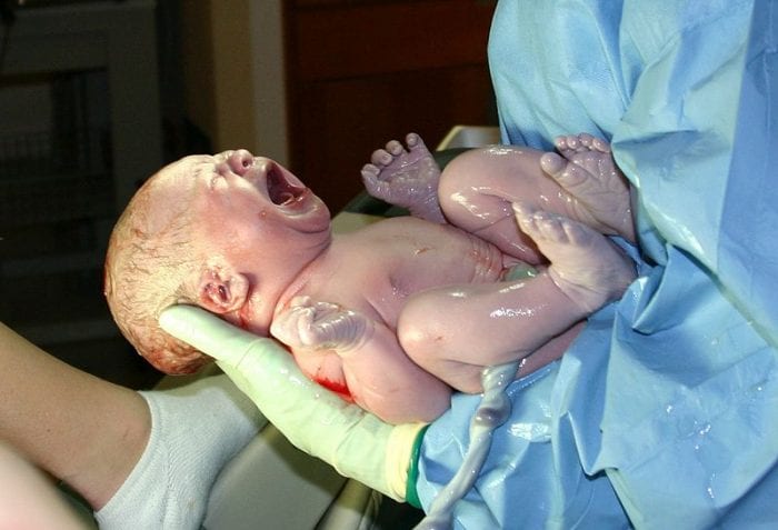 A doctor carrying a newborn baby that has just been delivered