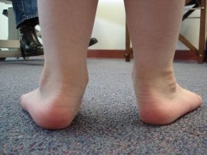 children shoes - Feet completely flat on the floor. This requires the right footwear for the necessary arch support.