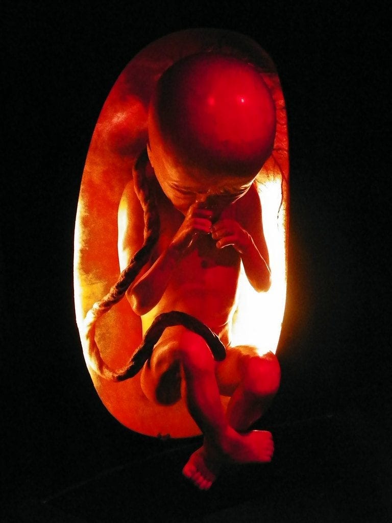 This is how womb looks like of pregnant women. is this little one sucking his/her thumb? a peak inside the home of a growing infant, the uterus