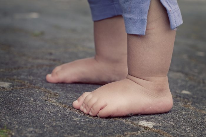 Why You Should Get Ankle Support Shoes For Toddlers Family Hype