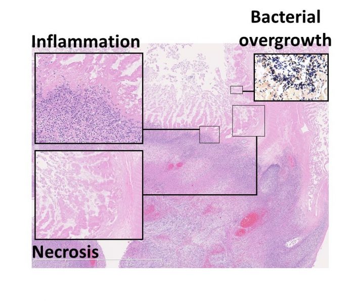 newest formula bacterial growth through a microscope