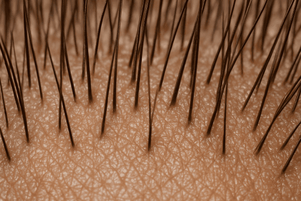Macro shot of a healthy, hydrated scalp with densely packed, shiny hair follicles.